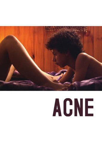 Poster of Acne